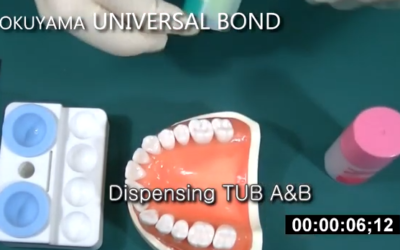 Tokuyama Universal Bond | 25 seconds | Competitor Speed Comparison